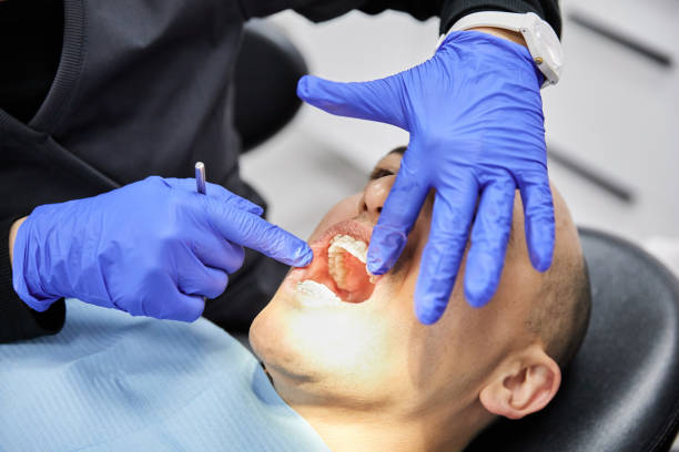 Best Emergency Dental Care for Broken or Chipped Teeth in Joliet, IL
